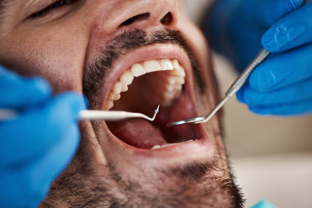 Best Emergency Dental Care for Sports Injuries in Oradell, NJ