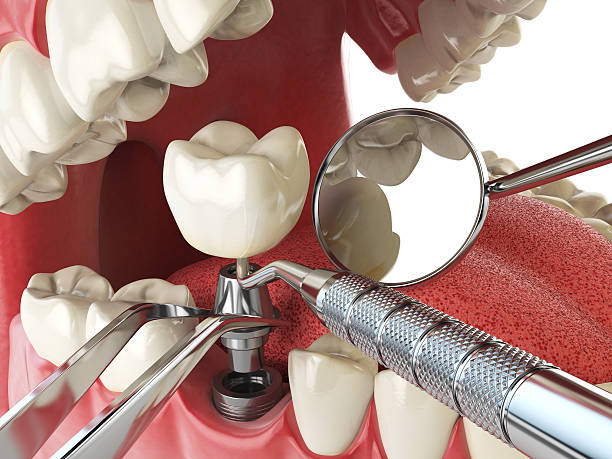 Best Emergency Care for Gum Disease in Oradell, NJ